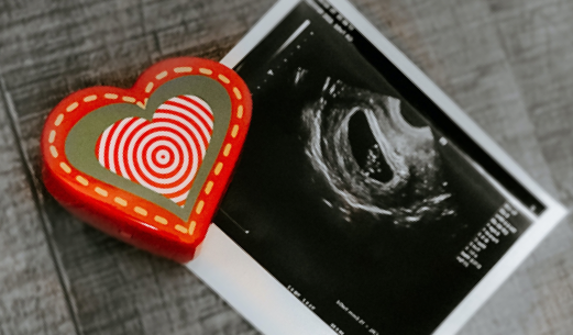 Box with heart on it next to ultrasound picture